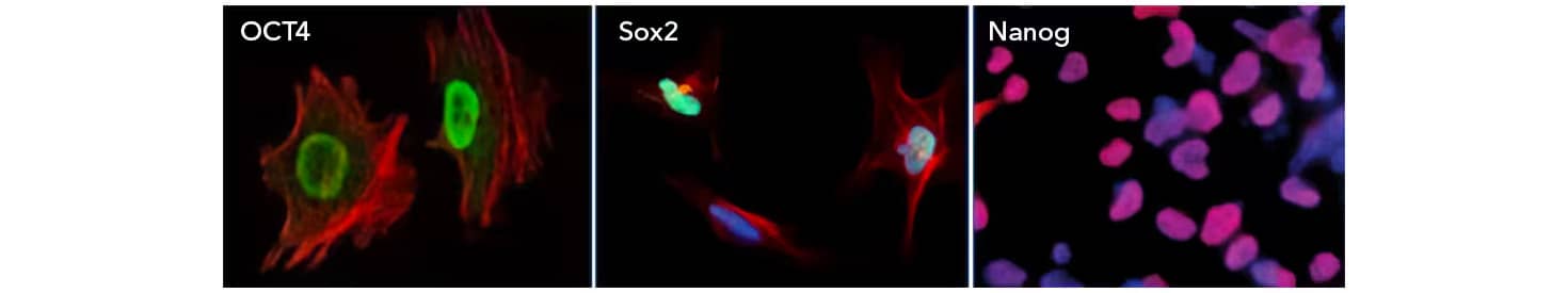 mmunocytochemistry/Immunofluorescence Data Image