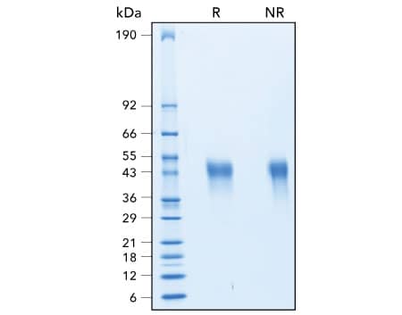 Purity of R&D Systems Recombinant Human TIM-3 protein assessed by SDS-PAGE under reducing and non-reducing conditions.