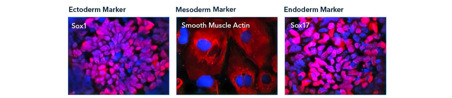 Trilineage differentiation of mouse embryonic stem cells