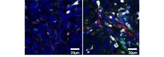 Ionizing radiation (IR) increases the presence of tumor associated macrophages (TAMs). Immunohistochemistry analysis.