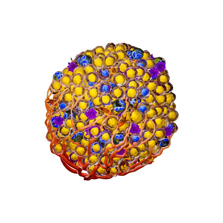 Tumor Luminex Biomarker 