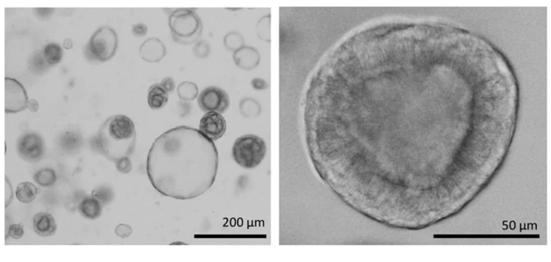 Brightfield images of adult stem cell-derived human lung organoids on day 52 of culture