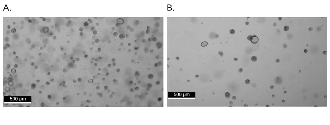 Brightfield image showing the density of human lung organoids after 25 days in culture before and after passaging