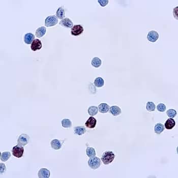 Immunocytochemical detection of adenovirus infected cells with anti-adenovirus mouse monoclonal antibody.