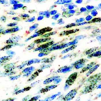 Immunocytochemical detection of HHV8 infected cells with anti-ORF73/HHV8 rat monoclonal antibody.