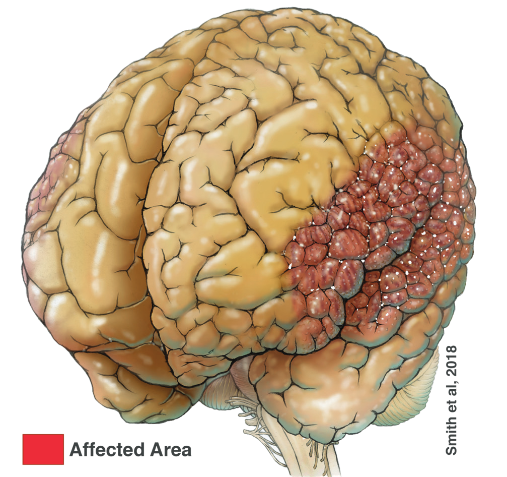 A illustration of a brain