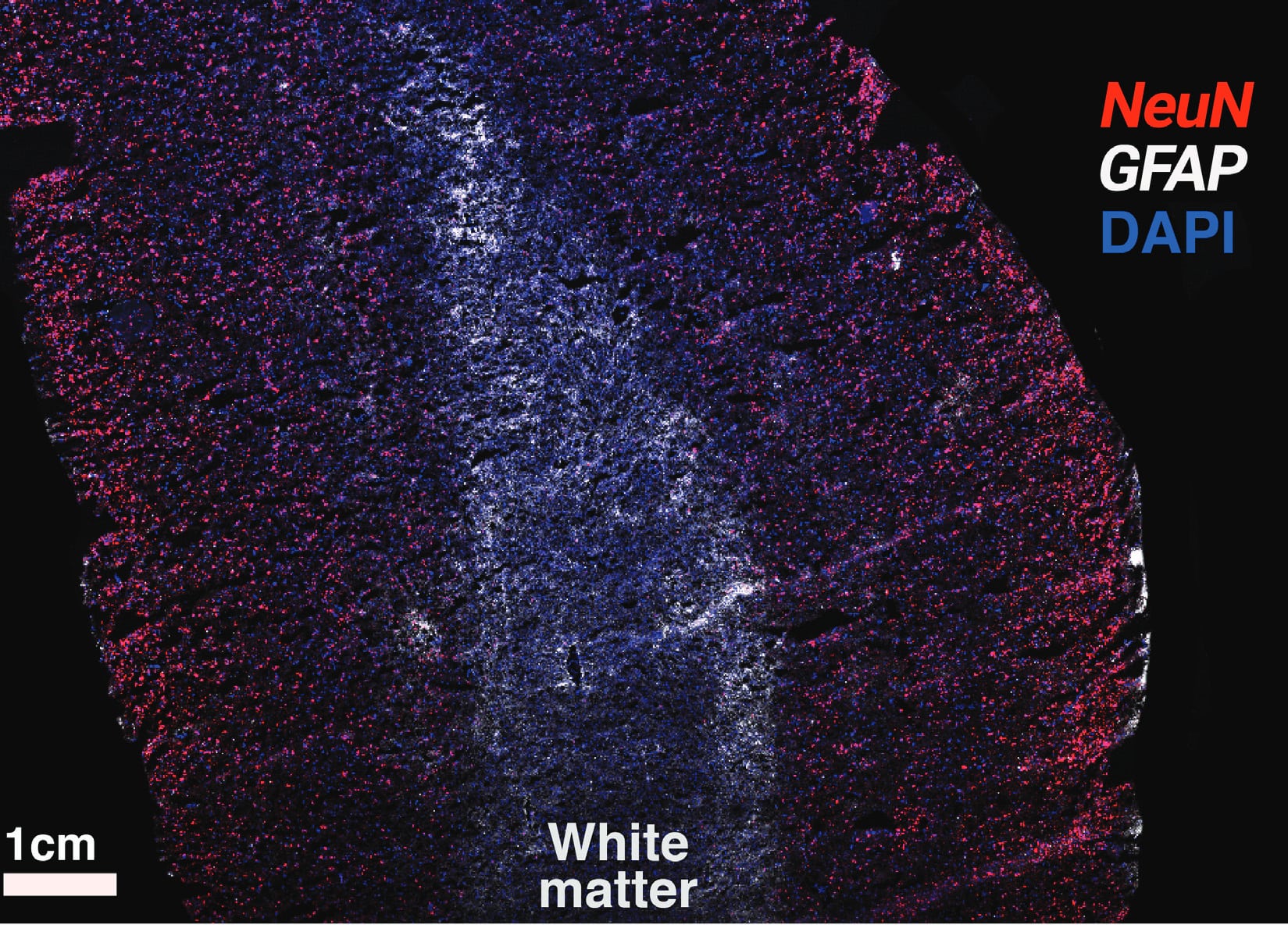 A DAPI image of a brain