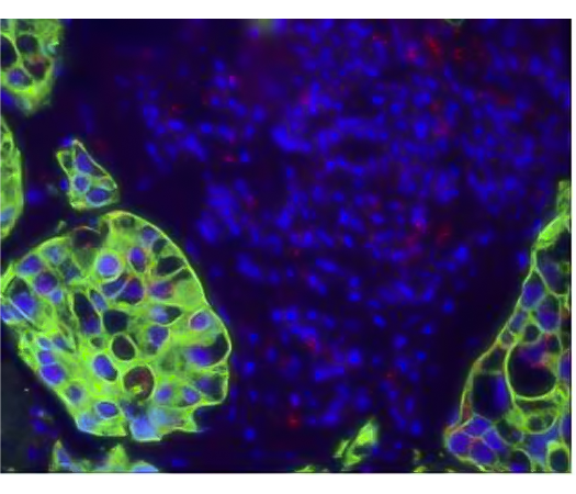 Figure 3. Dual ISH-IHC using fluorescent staining to identify PPI mRNA expression (red dot) and CAM5.2 protein expression (