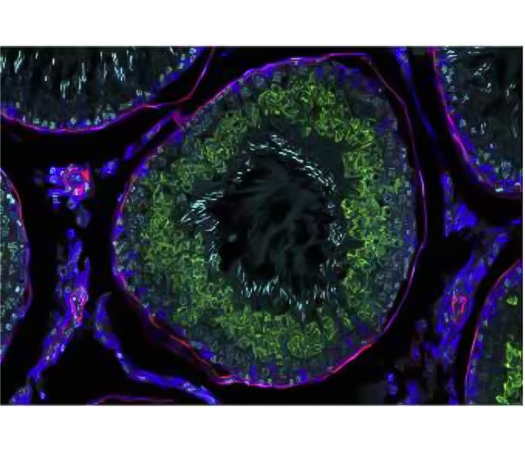 Figure 4 Detection of one mRNA and 2 proteins. Provided by Mike Millar