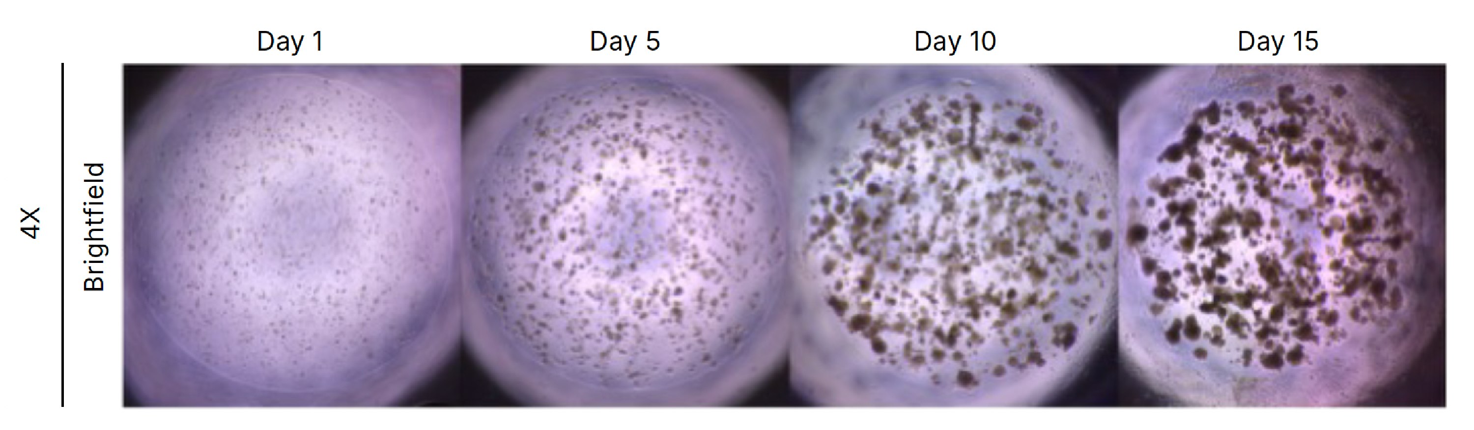 Progression of spheroid formation inside Cultrex UltiMatrix domes. Spheroid formation was monitored for 15 days. Cells were observed to aggregate from Day 5 onwards. The formed spheroids varied in size and shape, but their form mainly was spherical.