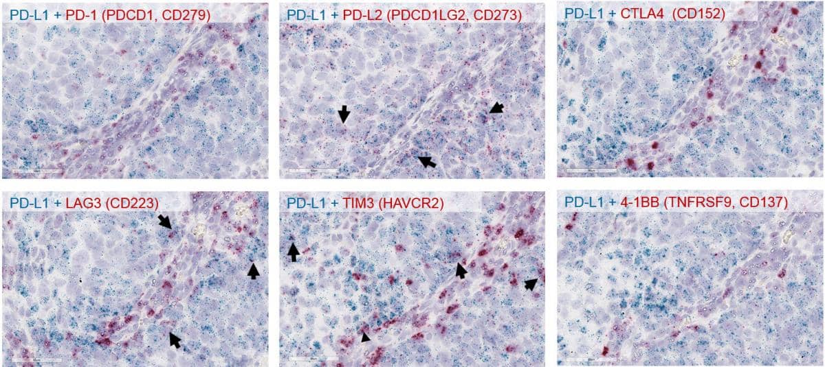Detect expression of the immune checkpoint markers PD-L1 Coexpression RNAscope 
