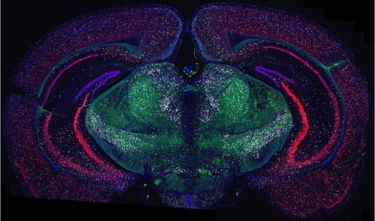 Detection of glutaminergic neurons Vglut1, Vglut2 and GABAergic neurons Vgat expression in the FFPE mouse brain with RNAscope® Multiplex Fluorescent Assay