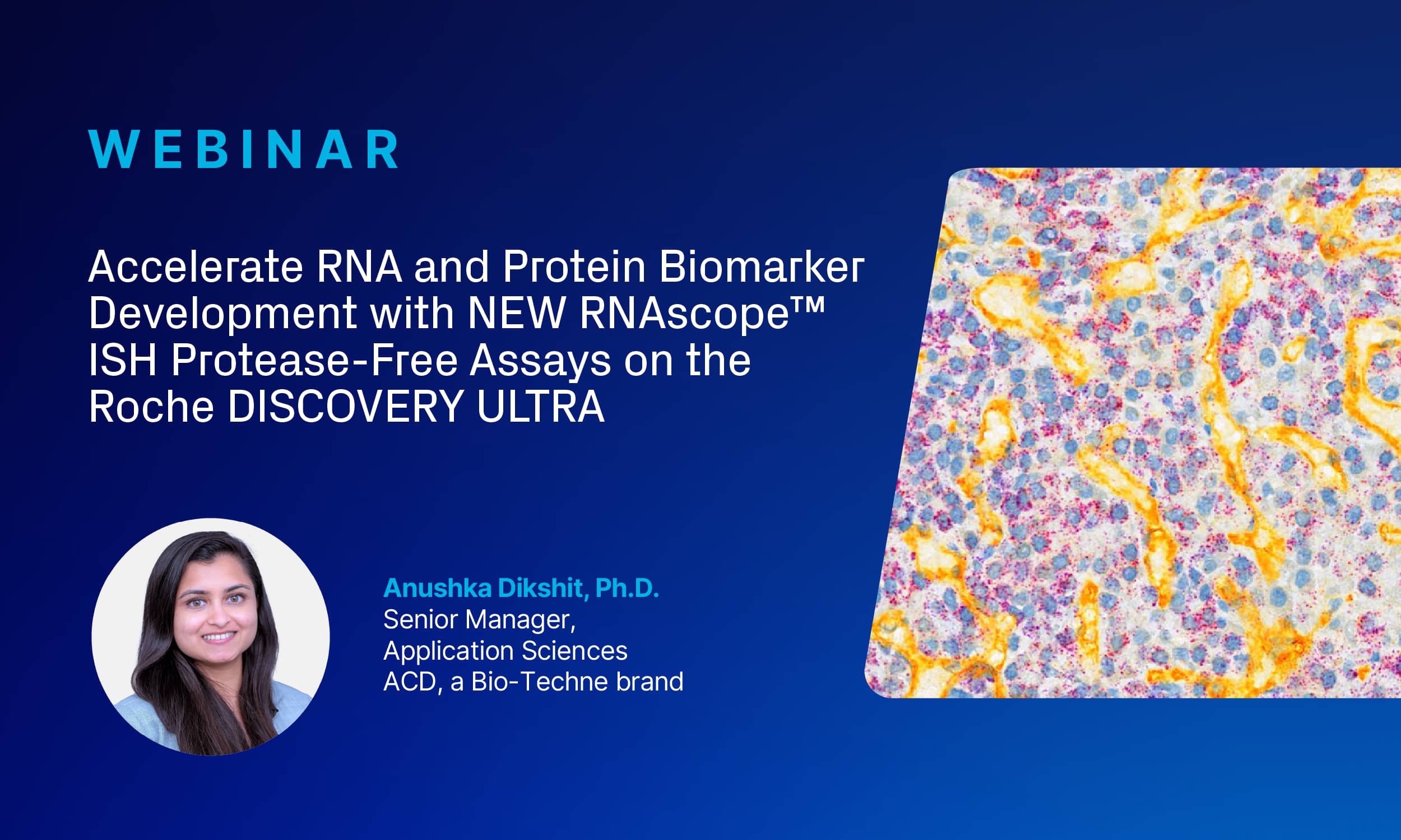 Accelerate RNA and Protein Biomarker Development with NEW RNAscope™ ISH Protease-Free Assays on the Roche DISCOVERY ULTRA Webinar