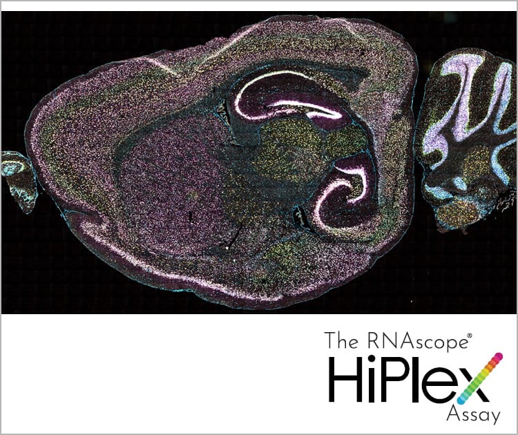 RNA profiling for Cancer Biomarker Discovery