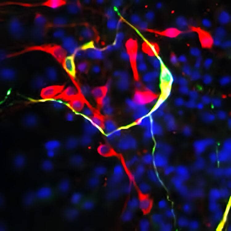 Staining of dopaminergic neurons with anti-tyrosine hydroxylase in green, anti-neuron-specific beta III tubulin Tuj1 in red and DAPI in blue