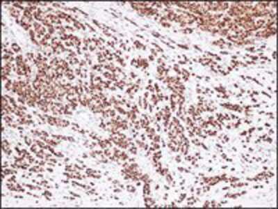 Immunohistochemistry-Paraffin: ER alpha/NR3A1 Antibody (S21-V) [NBP1-30153]