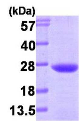 Western Blot: Recombinant Human VPS28 Protein [NBP1-30248]