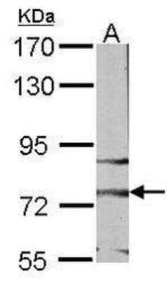 Western Blot: Frizzled-3 Antibody [NBP1-30940]