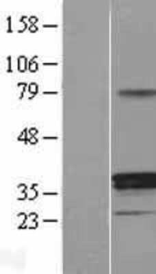 Western Blot: 11 beta-HSD1 Overexpression Lysate [NBL1-11718]