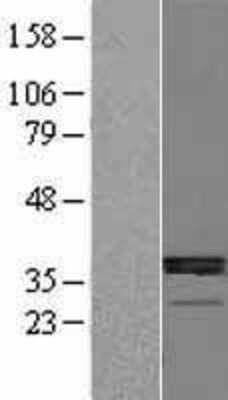 Western Blot: 11 beta-HSD1 Overexpression Lysate [NBL1-11719]