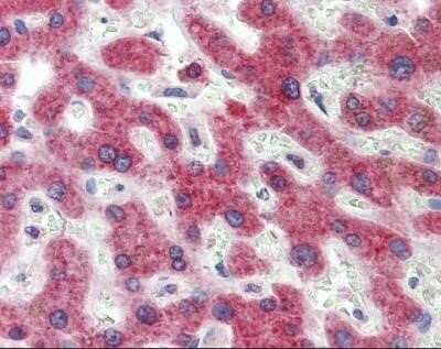 Immunohistochemistry-Paraffin: 11 beta-HSD1 Antibody [NBP1-69644]