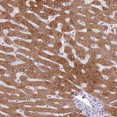 Immunohistochemistry-Paraffin: 11 beta-HSD1 Antibody [NBP2-48879]
