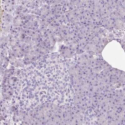 Immunohistochemistry-Paraffin: 11 beta-HSD1 Antibody [NBP2-48879]