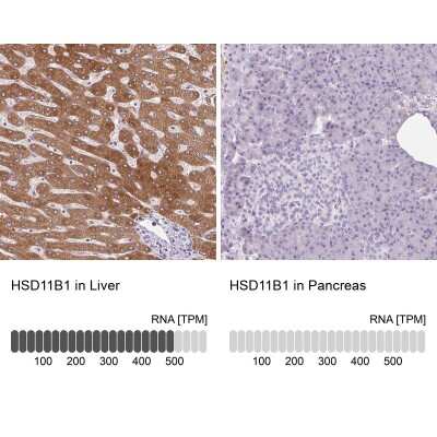 Immunohistochemistry-Paraffin: 11 beta-HSD1 Antibody [NBP2-48879]