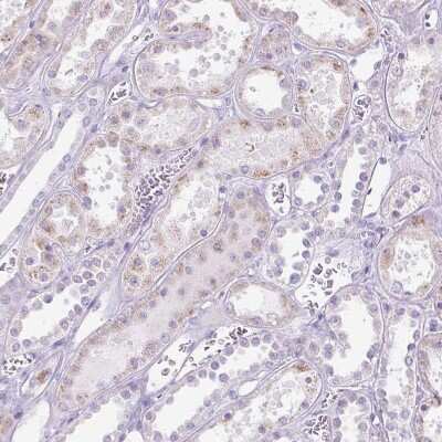 Immunohistochemistry-Paraffin: 11 beta-HSD1 Antibody [NBP2-48879]