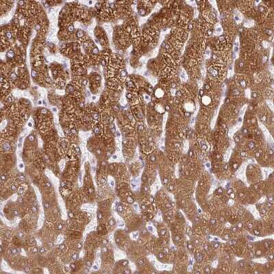 Immunohistochemistry-Paraffin: 11 beta-HSD1 Antibody [NBP2-48879]