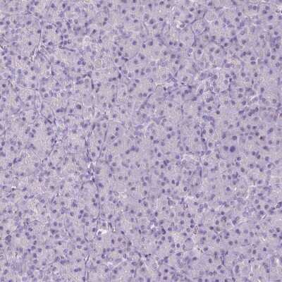 Immunohistochemistry-Paraffin: 11 beta-HSD1 Antibody [NBP2-48879]