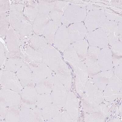 Immunohistochemistry-Paraffin: 11 beta-HSD1 Antibody [NBP2-48879]