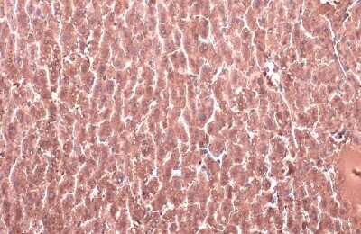Immunohistochemistry-Paraffin: 11 beta-HSD1 Antibody [NBP3-13393]