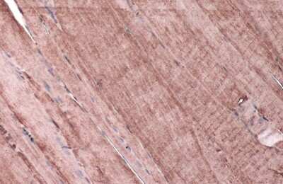 Immunohistochemistry-Paraffin: 11 beta-HSD1 Antibody [NBP3-13393]