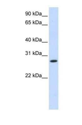 Western Blot: 11 beta-HSD1 Antibody [NBP1-69644]