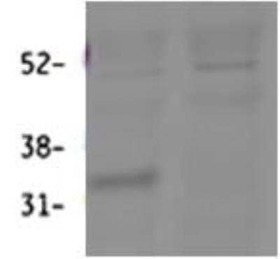 Western Blot: 11 beta-HSD1 Antibody [NBP2-27469]