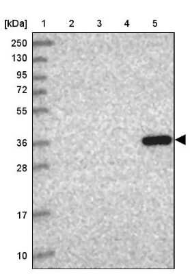 Western Blot: 11 beta-HSD1 Antibody [NBP2-48879]