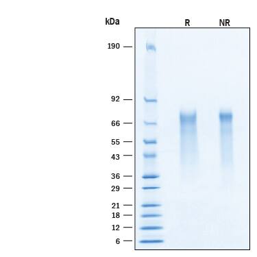 Recombinant Human Neuregulin-3/NRG3 His-tag Protein, CF (11520-NR) by R ...