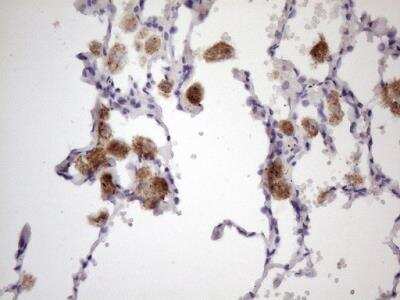 Immunohistochemistry-Paraffin: 12-Lipoxygenase Antibody (OTI1C3) [NBP2-46512]