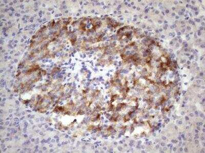Immunohistochemistry-Paraffin: 12-Lipoxygenase Antibody (OTI1C3) [NBP2-46512]