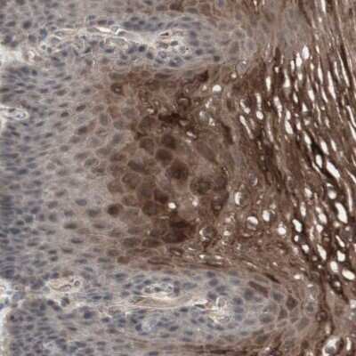 Immunohistochemistry-Paraffin: 12-Lipoxygenase Antibody [NBP1-90338]