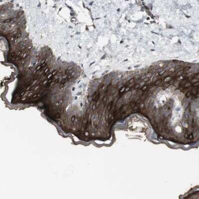 Immunohistochemistry-Paraffin: 12-Lipoxygenase Antibody [NBP1-90338]