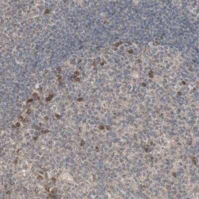Immunohistochemistry-Paraffin: 12-Lipoxygenase Antibody [NBP1-90338]