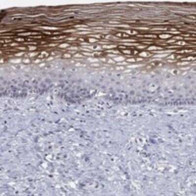 Immunohistochemistry-Paraffin: 12-Lipoxygenase Antibody [NBP3-17678]