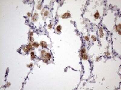 Immunohistochemistry: 12-Lipoxygenase Antibody (OTI1C3) - Azide and BSA Free [NBP2-70165]