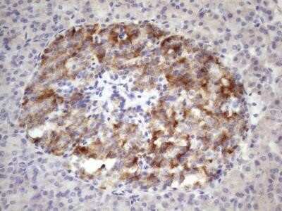 Immunohistochemistry: 12-Lipoxygenase Antibody (OTI1C3) - Azide and BSA Free [NBP2-70165]