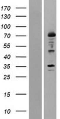 Western Blot: 12-Lipoxygenase Overexpression Lysate [NBP2-10693]