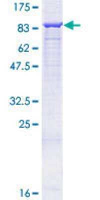 Western Blot: Recombinant Human 12-Lipoxygenase GST (N-Term) Protein [H00000239-P01]