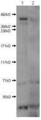 Western Blot: Huntingtin Antibody [NBP1-44266]