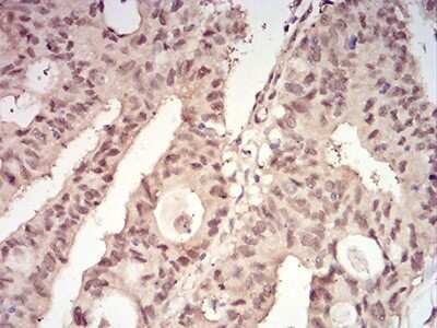 Immunohistochemistry: 14-3-3 beta/alpha Antibody (5B5G10) - BSA Free [NBP2-61780]